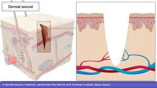 Skin Wound Healing Process [upl. by Opal]