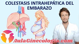 COLESTASIS INTRAHEPÁTICA DEL EMBARAZO causas síntomas y tratamiento  Ginecología y Obstetricia [upl. by Redmer]