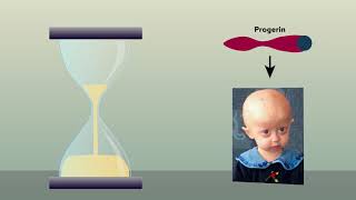 Cell disruption caused by mutant prelamin A protein points to origin of progeria [upl. by Eikin]