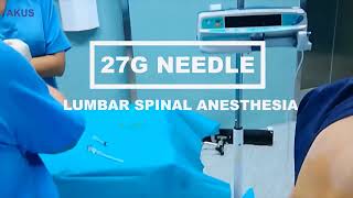 Spinal Needle Akusinnovation [upl. by Gonzales]