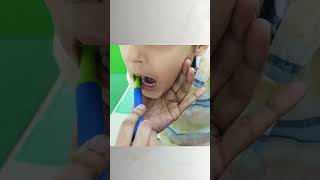 Oral Sensory Integration Therapy by Dr Inchie Lonial [upl. by Fran]