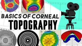 Corneal topography and tomography Course  part one  1 [upl. by Aviv]