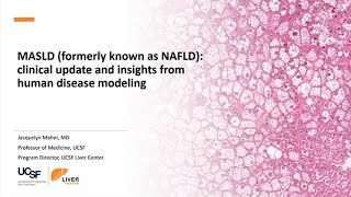 972023  MASLD Formerly Known As NAFLD Clinical Update and Insights From Human Disease Modeling [upl. by Greenstein]