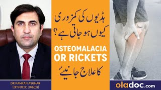 What Is Osteomalacia  Osteomalacia Kya Hota Hai  Osteomalacia Treatment Hadion Ki Kamzori Ka Ilaj [upl. by Meerak]