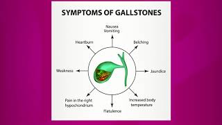 Symptoms of Gallstones [upl. by Enenaj51]