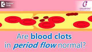 Why does menstrual bleeding have blood clots Is it normalDrShalini Varma of Cloudnine Hospitals [upl. by Drarrej]