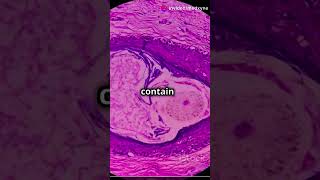 What is a Teratoma Understanding This Rare Tumor healthtips facts pharmacology [upl. by Fen901]