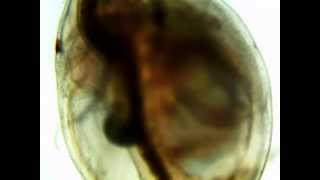 Daphnia Heart Rate Diphenhydramine [upl. by Ahsayn218]