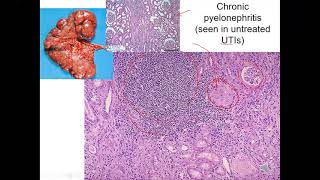 BIO3120065 KIDNEY PATHOLOGY LAB 41321 [upl. by Ailehc]