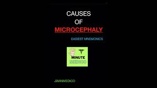 MICROCEPHALY CAUSES  PEDIATRICS EASIEST MNEMONIC 5MINMEDICO next neetpg shorts [upl. by Elahcar610]