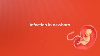 Infection in Newborn  Dr TJ Anthony  Medanta Gurugram [upl. by Faber]