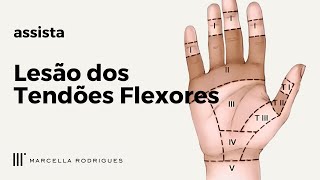 Lesão dos Tendões Flexores [upl. by Tnecillim]