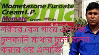 মোমেট ক্রিম ইউজ কিভাবে করবেন2021 [upl. by Adgam56]