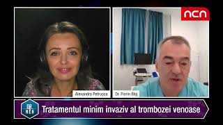 Tromboza venoasa profunda  tratament rapid si minim invaziv  dr Florin Bloj [upl. by Candice]