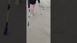 functional neurological disorder FND walking with crutches [upl. by Bagger260]