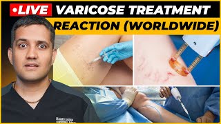 My Reaction on Venaseal Sclerotherapy amp Laser Treatment for varicose veins  Dr Gaurav G IR [upl. by Pasquale]