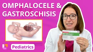 Omphalocele amp Gastroschisis  Pediatric Nursing  LevelUpRN [upl. by Gleich]