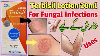 Terbisil Lotion 20ml  Terbinafine  For Fungal Infections Uses Benefits ​⁠ChMedicinePoint [upl. by Salamone]