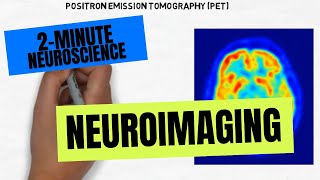 2Minute Neuroscience Neuroimaging [upl. by Bernard532]