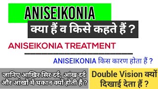 Aniseikonia क्या हैं व किसे कहते हैं  Aniseikonia क्यों होता हैं  Aniseikonia Treatment  in Hindi [upl. by Rayham]