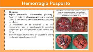 Hemorragia Posparto 12  Ginecología [upl. by Oterol]