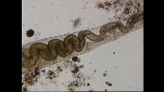 Phyllum annelida oligochaeta worms [upl. by Denys]