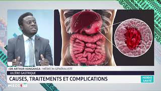 Ulcère gastrique causes traitements et complications [upl. by Etienne561]