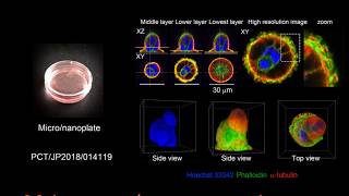 New microplatform reveals cancer cells’ natural behavior [upl. by Hudson887]