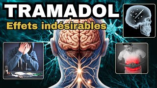 TRAMADOL et ses EFFETS INDESIRABLES à connaître [upl. by Yoshiko318]