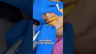 Lips blushing treatment for lips lightening ✅skin smile clinic Bhopal lipsblushing lipslightening [upl. by Alomeda481]