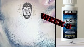 Minoxidil Beard  Week 8  Minoxidil 5 for Beard Growth  FacialFuzzFridays [upl. by Helbon693]