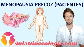 MENOPAUSIA PREMATURA o PRECOZ PACIENTES Necesidad de tratamiento  Ginecología y Obstetricia [upl. by Airasor918]