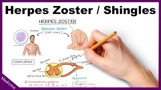 Herpes ZosterShingles Symptoms Diagnosis Treatment [upl. by Viehmann]