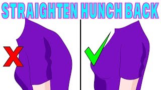 The 4 minute solution to correct hunchback kyphosis [upl. by Novihc]