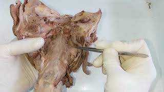 Dissection  Constrictors of Pharynx [upl. by Lyrradal]