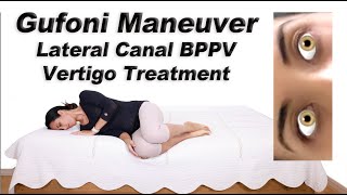 Gufoni Maneuver to Treat BPPV of the Lateral Canal Ageotropic and Geotropic Variations [upl. by Magocsi466]