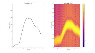 Sonification of fNIRS single channel HRF hemodynamic response function [upl. by Laws]