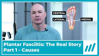 Plantar Fasciitis Part 1 What is it What Caused it [upl. by Enoek]