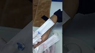 IV Cannula  Intravenous cannula method  IV cannulation technique [upl. by Silera]