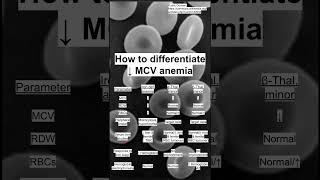 How to differentiate ↓ MCV anemia [upl. by Clevey]