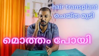 Hair transplantation after 20 days  ഇത്ര ദിവസം കൊണ്ട് മുടിക്ക് വന്ന മാറ്റം  safvan pullara [upl. by Ylra]