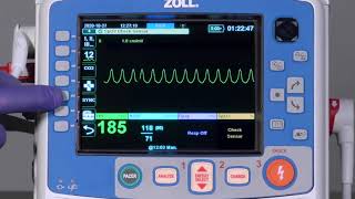 X Series® Advanced Cardioversion English [upl. by Lowery444]