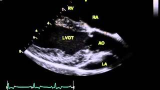 Normal canine echo  right parasternal long axis LVOT view [upl. by Asined804]