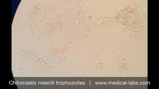 Chilomastix mesnili Trophozoites Lab 4 صيدلة ثانية  طفيليات عملي [upl. by Carol-Jean132]