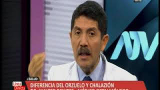 Dr Walter Benites  oftalmólogo  Orzuelo y chalazion ATV [upl. by Cataldo]