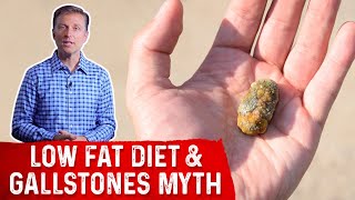 The Low Fat Diet to Prevent Gallstones quotMythquot – Dr Berg [upl. by Atina]