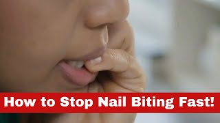 End the Chew How to Stop Nail Biting Fast [upl. by Herschel209]