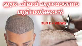 Cost of hair transplantation  മുടി നടാൻ എനിക്ക് ചെലവായത്ചിലവായത്  safvan pullara [upl. by Ogir65]