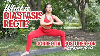 Ever heard of Diastasis Recti [upl. by Novar507]