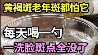 手上脸上都是斑？厨房一物是祛斑法宝，早上喝一勺，2天后一洗脸黄褐斑、老年斑就哗哗往下掉！气色比20年前还好！【饮食养生大智慧】 [upl. by Polish747]